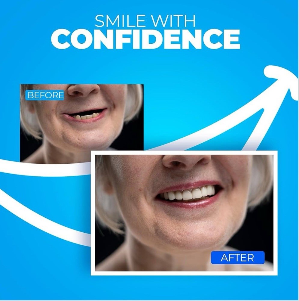 DIY DENTURE KIT Complete Custom Dentures Temporary Teeth Tooth * FULL /PARTIAL*