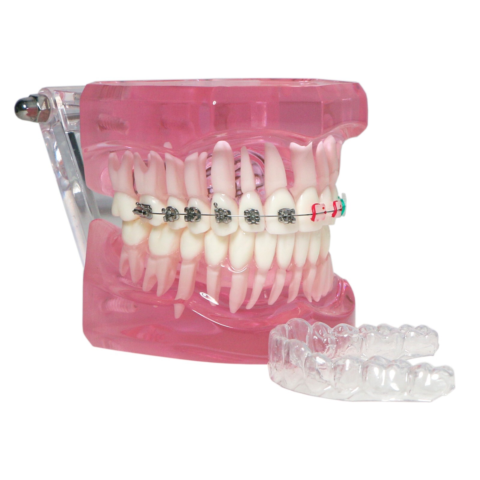 Dental Ortho Teeth Model With Metal Ceramic Brackets Lingual Braces Tube Teach