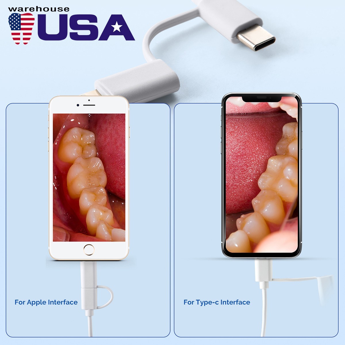 USB-C Intraoral Camera 1920*1440P HD 8 LED Auto Focus Apple Android Dental