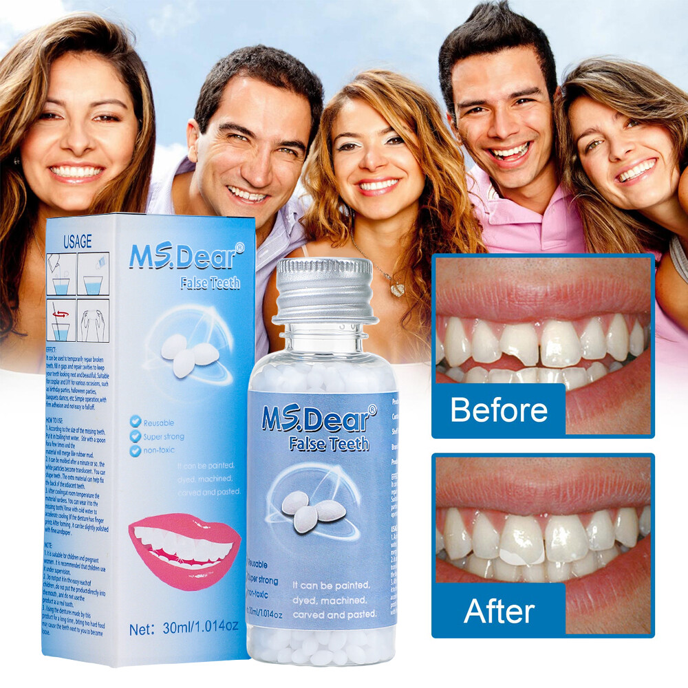 Resin False Teeth Solid Glue Temporary Tooth Repair Set Teeth And Gap Adhesive