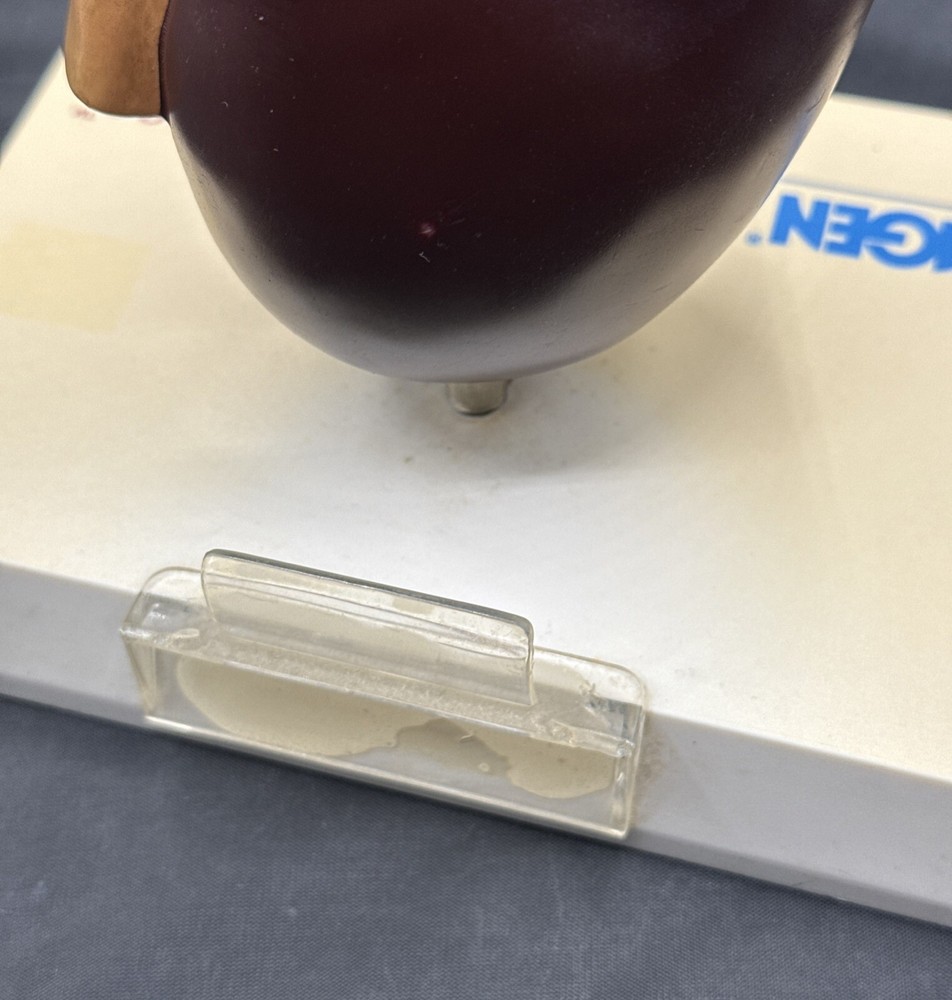 Amgen Renal Advances kidney 3d model Rare