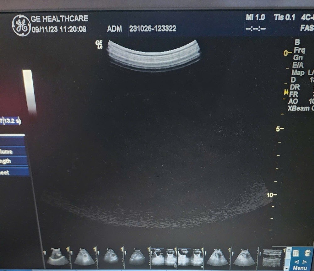 GE Ultrasound probe Convex 4C-D