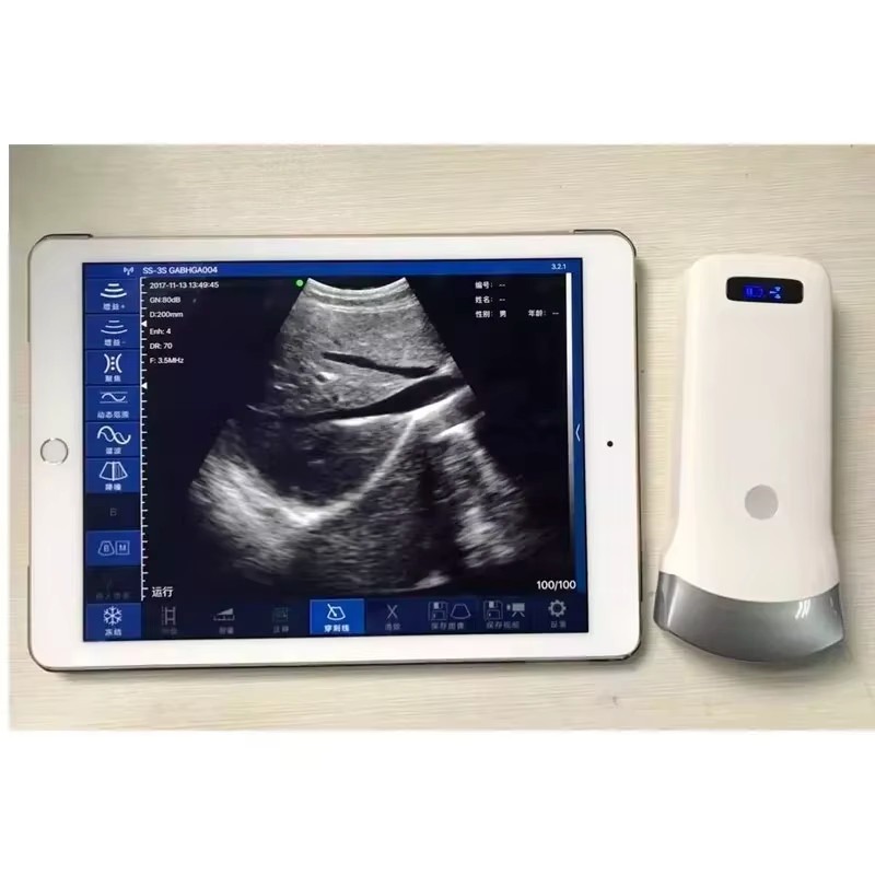 IOS Android Windows 80 Elements Convex Array Wireless Ultrasound Scanning Probe