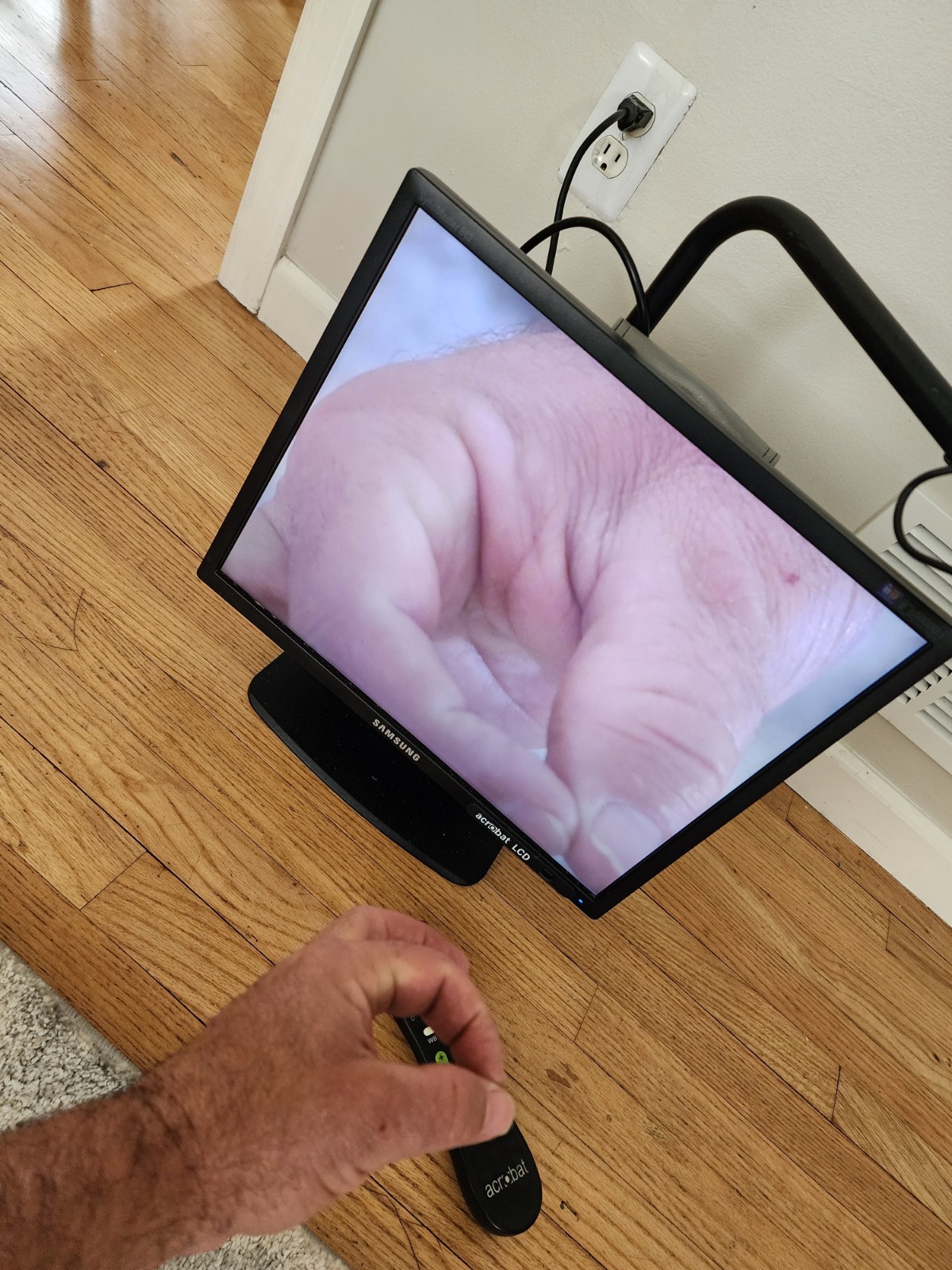 Acrobat LCD Enhanced and Remote