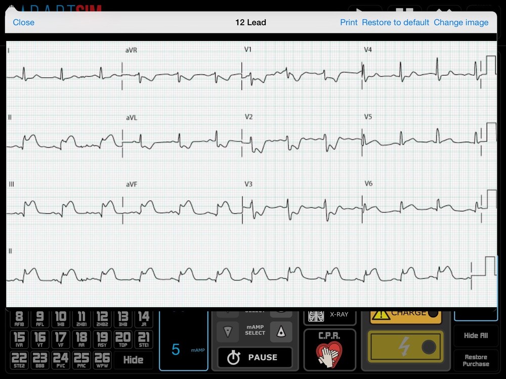DART Sim Bag Complete ACLS & PALS ECG Simulator/ Defib Simulator Kit