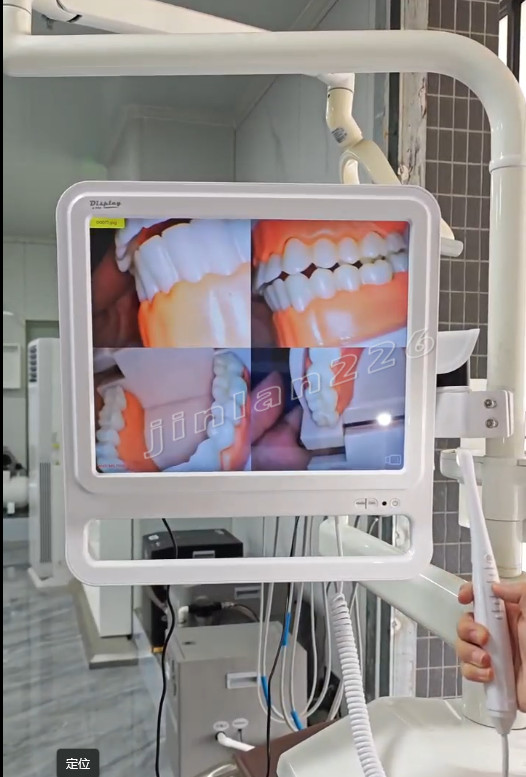 Dental Digital Intraoral Camera with Electric Monitor