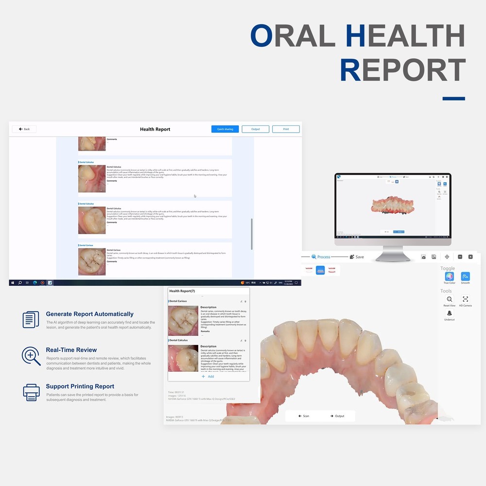 Dental Intraoral Scanner - Scanner & Cable & 4 Tips & Software