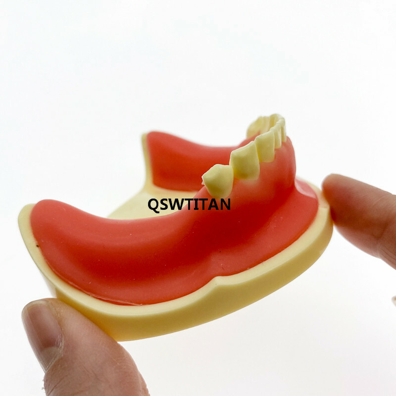 Teeth Model Implant Practice For incision drilling Practices Dental Study Model