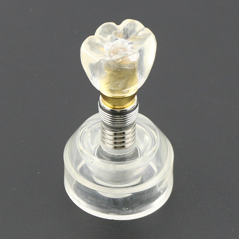 #2020 Dental Implant Model Demonstration Teeth Study Model Demonstrates Crown