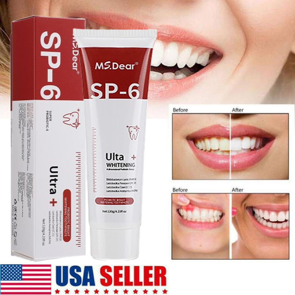 SP-6 Probiotic Toothpaste,Sp-6 Toothpaste Ultra Whitening Quick White Toothpaste