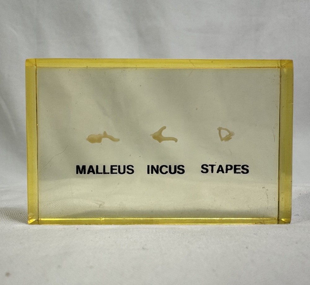 Vintage Embedded  Specimen Human Ossicles Ear Bones Osteology