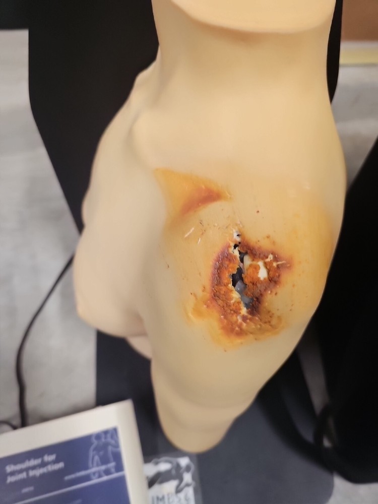 30010 Limbs & Things Shoulder for Joint Injection Training Trainer Simulator