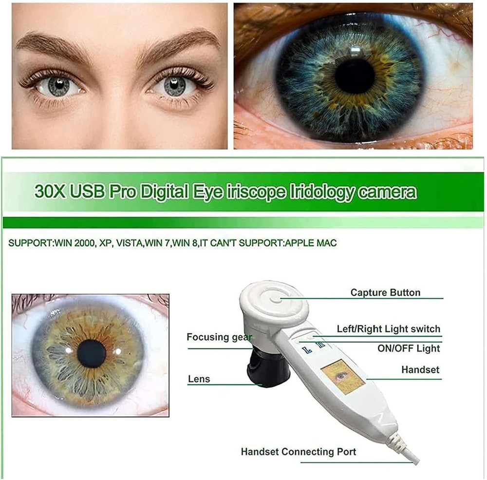 Analyzer Camera HD Iriscope Eye Camera with English Analysis Software for Eye US