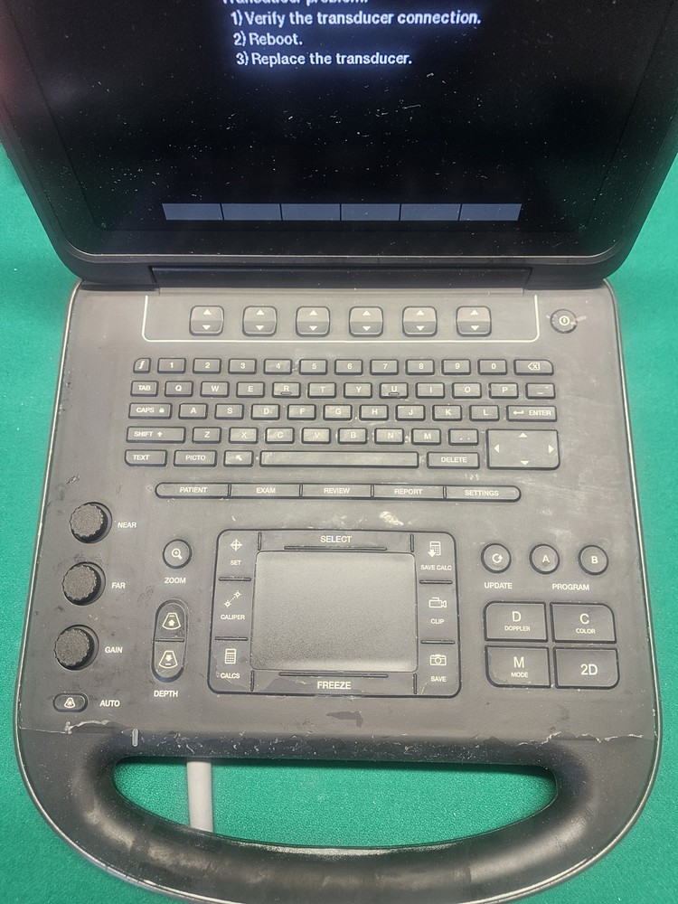 Sonosite Edge II Ultrasound System