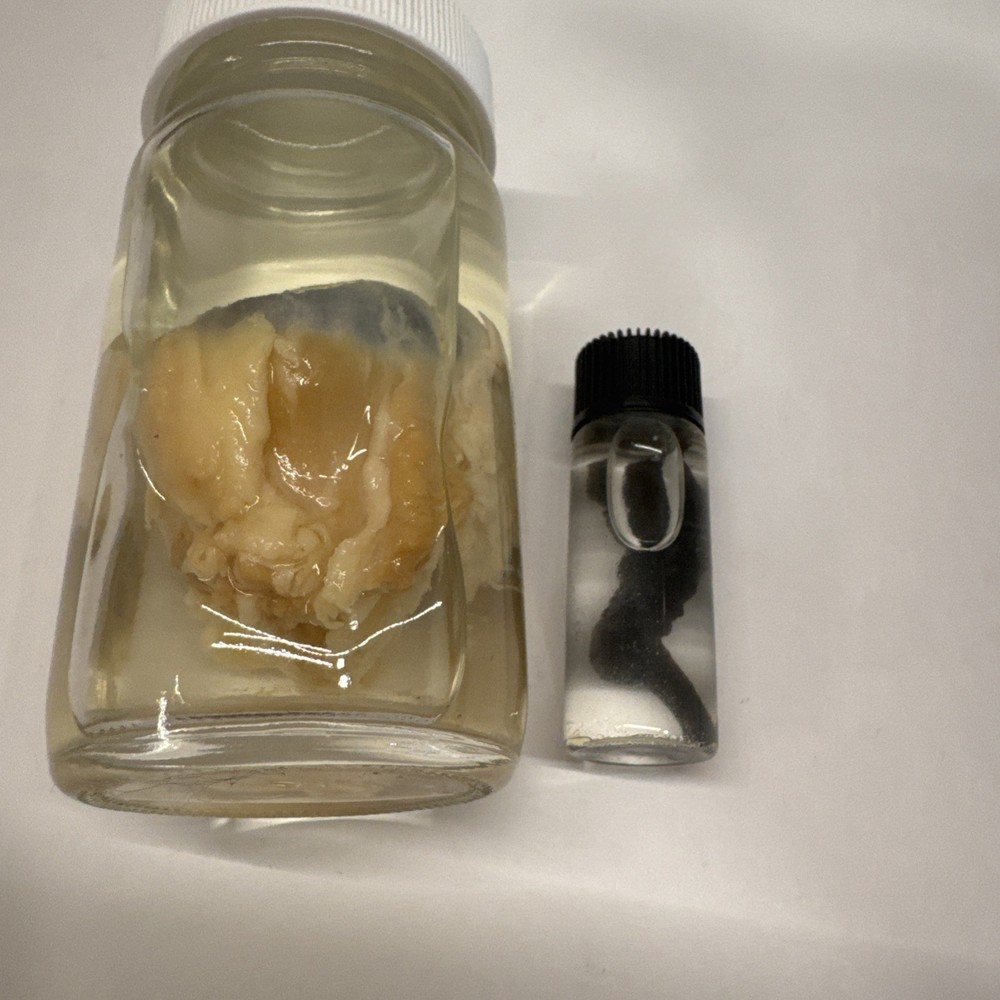 Oddities Jarred Specimens Spiny Shark Eye And Chicken Toe?