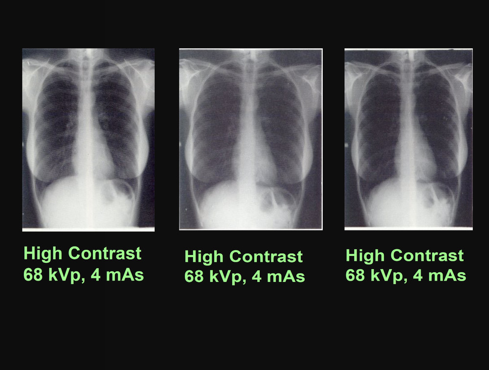 326 Page RADIOLOGY IMAGE ANALYSIS Density Contrast Quality Presentations on CD