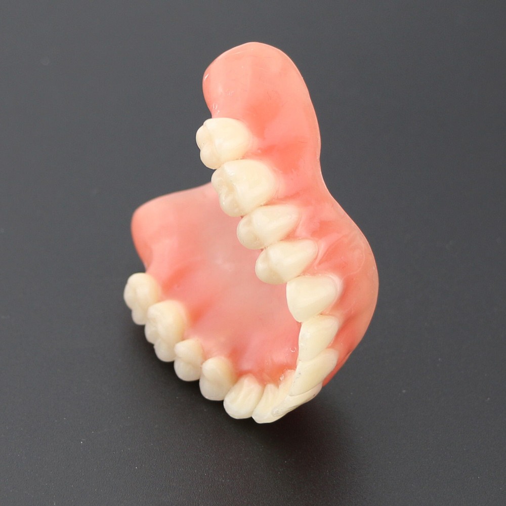 Dental Teeth Model Demo Overdenture Restoration With 4 Implants Upper Maxillary