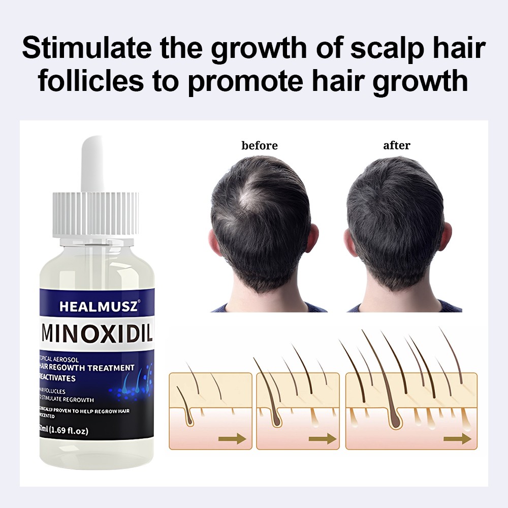 2 Pack Minoxidil 5% Extra Strength Men Hair Regrowth Treatment 2 Month Supply