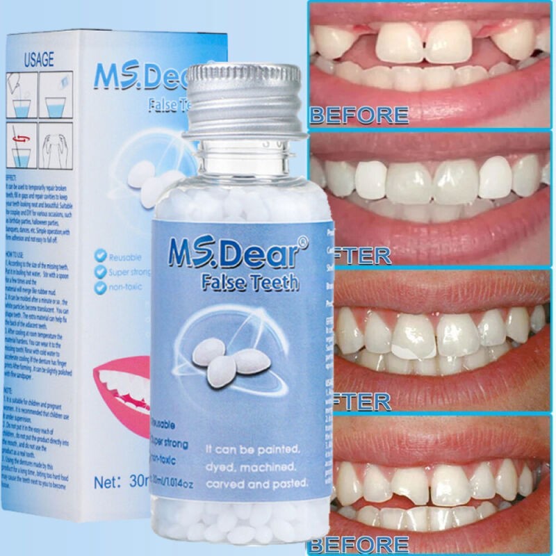 False Teeth Solid Glue Temporary Tooth Repair Moldable Fix Broke Gap Teeth 30ml
