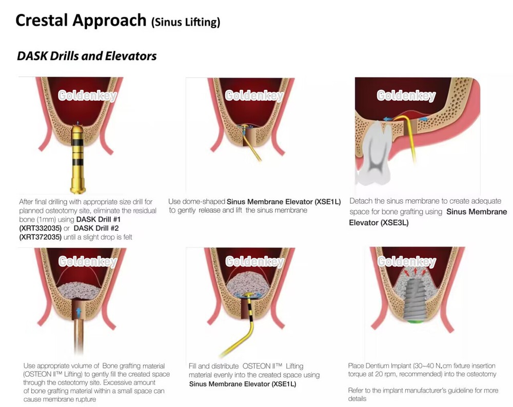 Dental DASK Handle Sinus Lift Implant Instruments Membrane Elevator