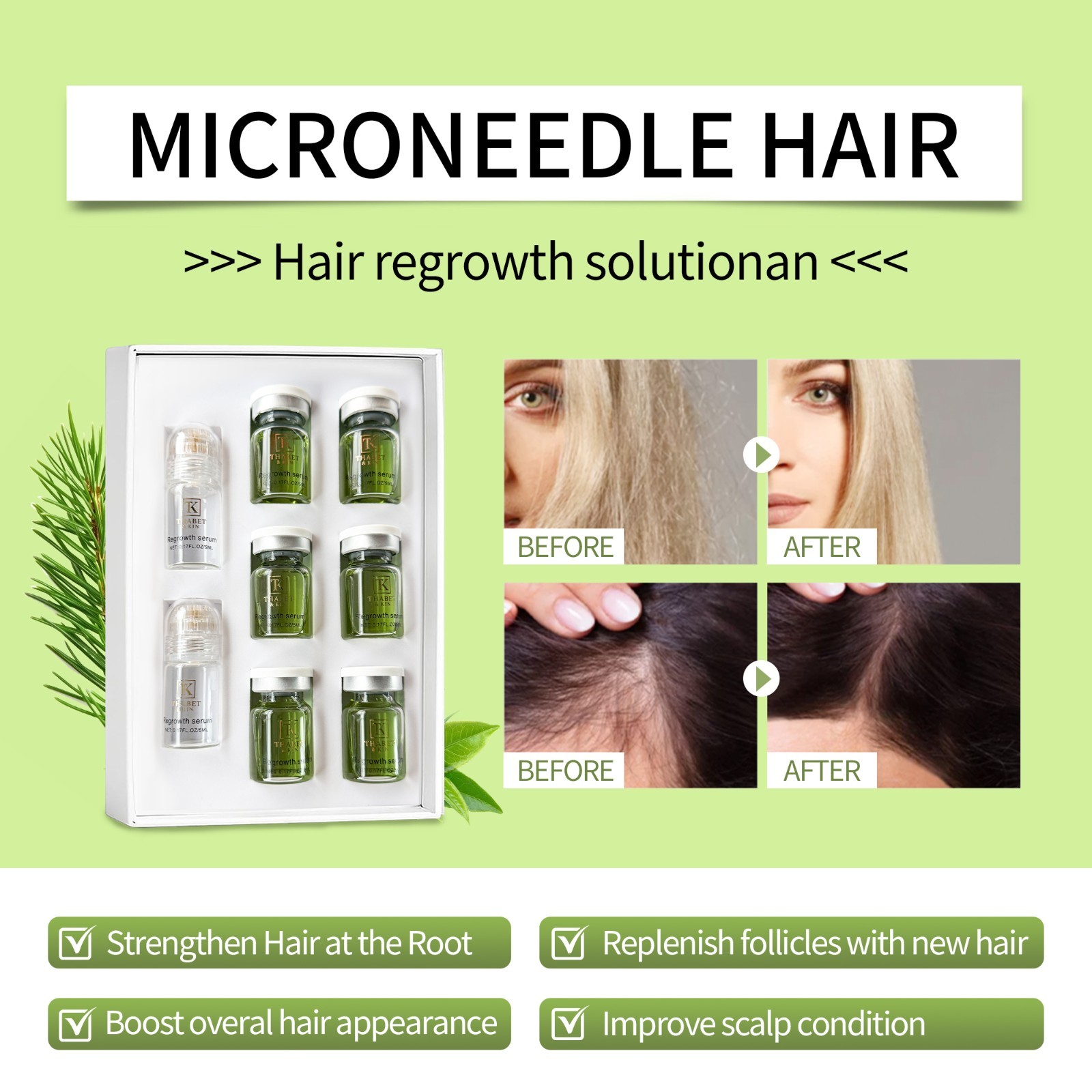 Infuse Hair Regrowth System, Advanced Hair Growth Treatment USA Brand FAST Ship