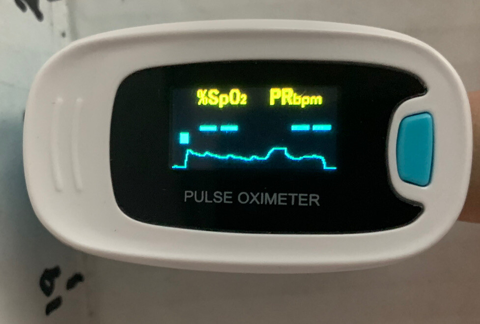 Pulse Oximeter CMS50NA