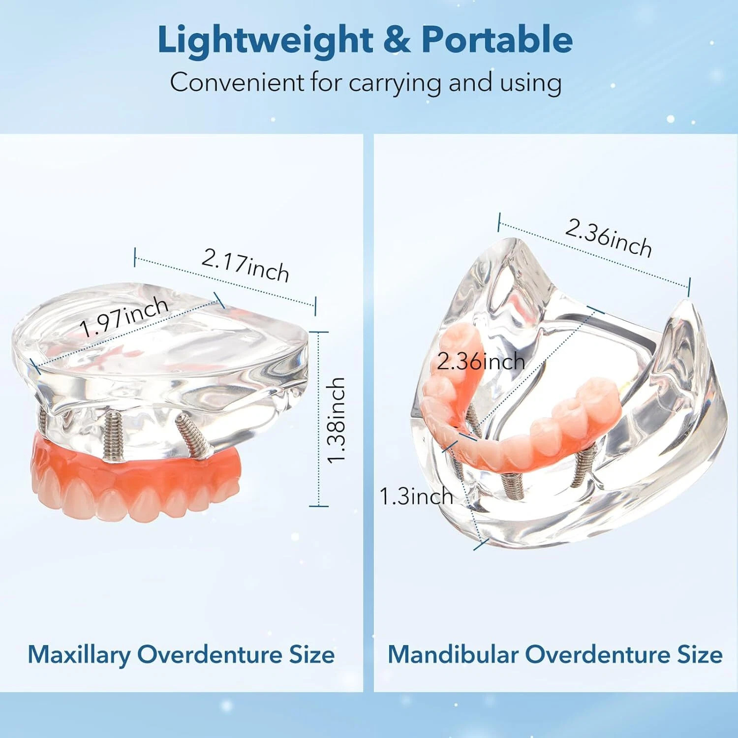 US Dental All-on-4 Overdenture Implant Model, Upper/Lower Jaw-Clear,With 4 Screw