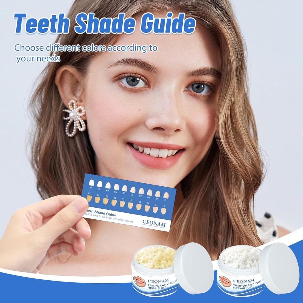 Temporary Tooth Replacement Kit - 3.5 oz White Repair Beads