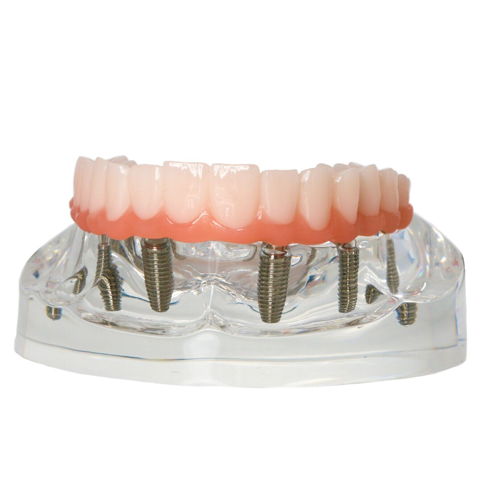 Dental All-On-6 Overdenture Implant Model Demo Upper Jaw 6 Screws Clear M6001-2