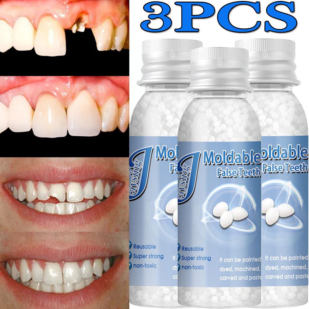 3X Tooth Repair Kit Temporary Teeth Replacement Beads for Missing & Broken Teeth
