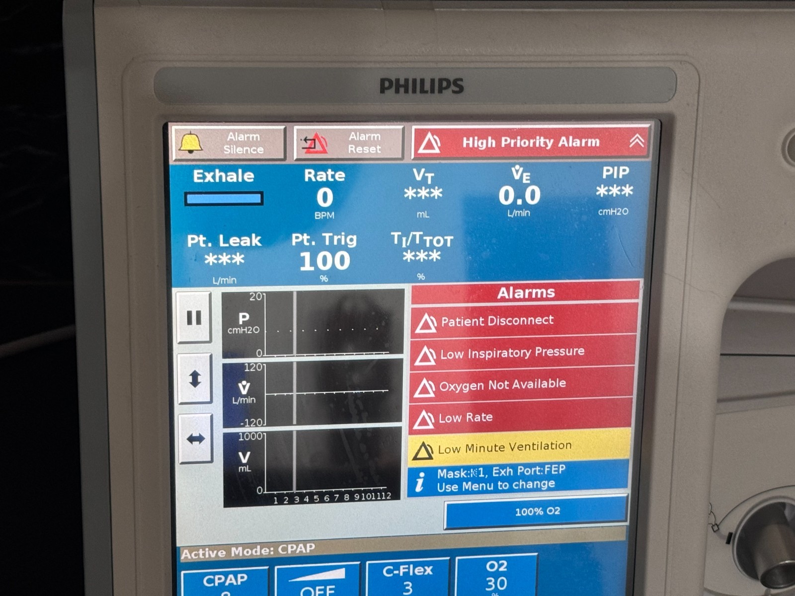 Philips V60 System 1033544