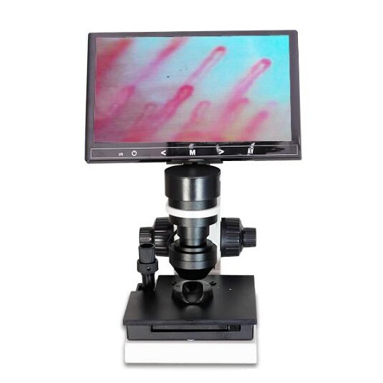 Digital Microscope Terminal Microcirculation Detection Nail Wall Observe Screen