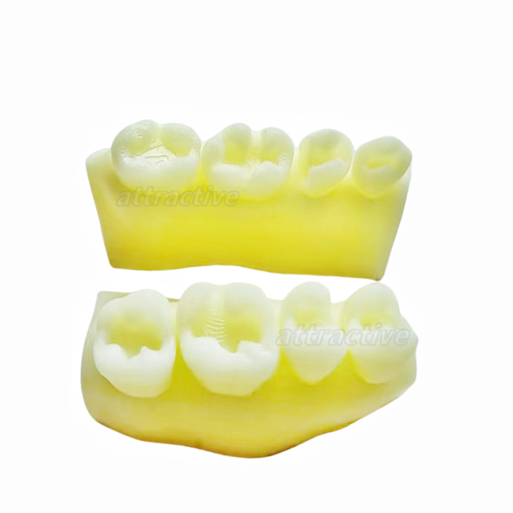 Dental Caries Decay Teeth Model Composite Resin Restore Tooth Simulate Class Ⅱ