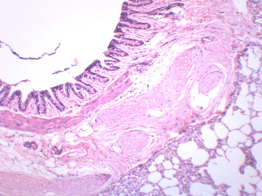 Human Lung Section - Prepared Microscope Slide - 75x25mm - Eisco Labs