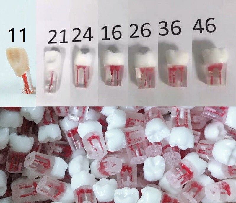 10x Dental clear Root Canal Teeth Study Practice Model Endodontic Pulp File