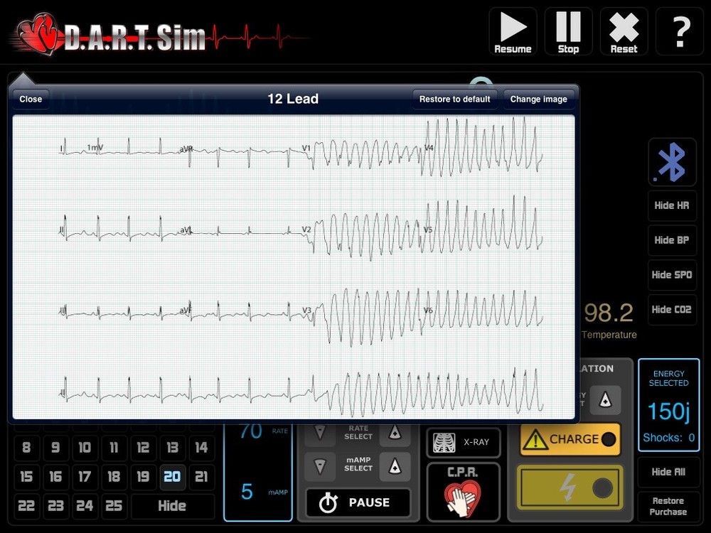 DART Sim Bag Complete ACLS & PALS ECG Simulator/ Defib Simulator Kit