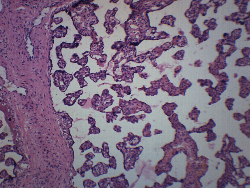 25PK Human Placenta Section - Prepared Slides - 75x25mm - Eisco Labs
