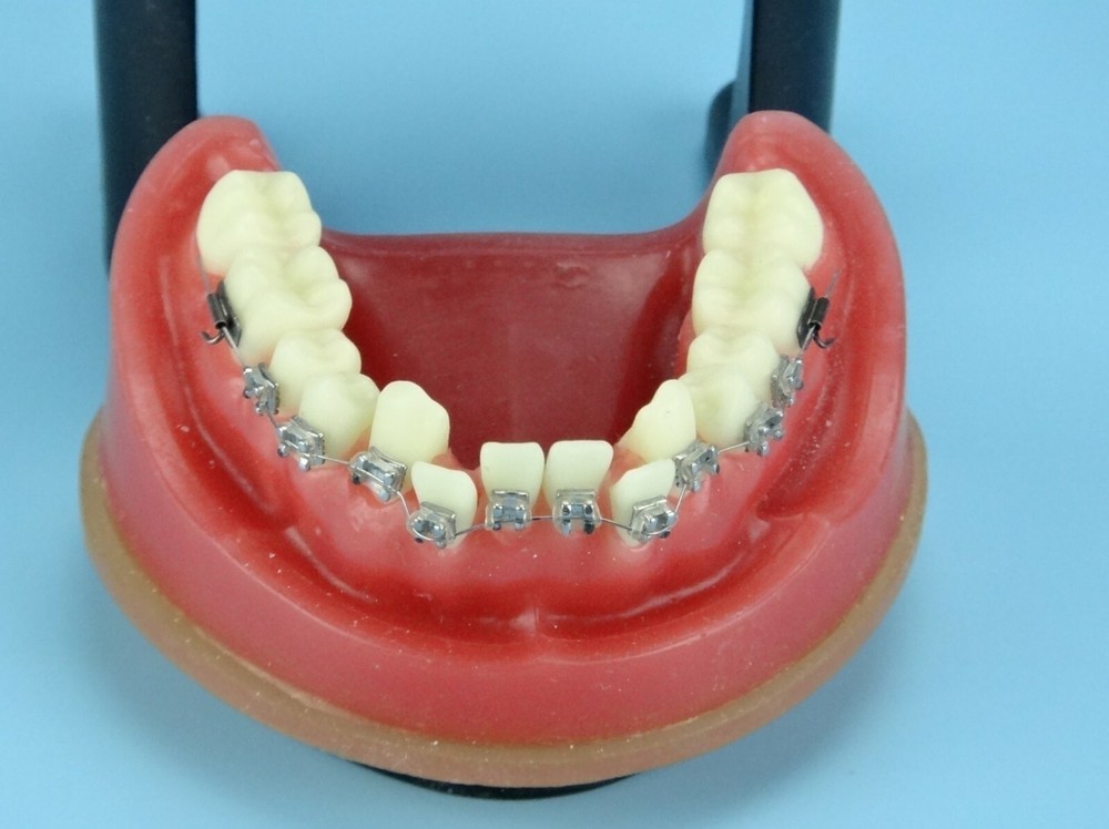 Reusable Dental Typodont Orthodontics Model Wax Teeth Training Practice