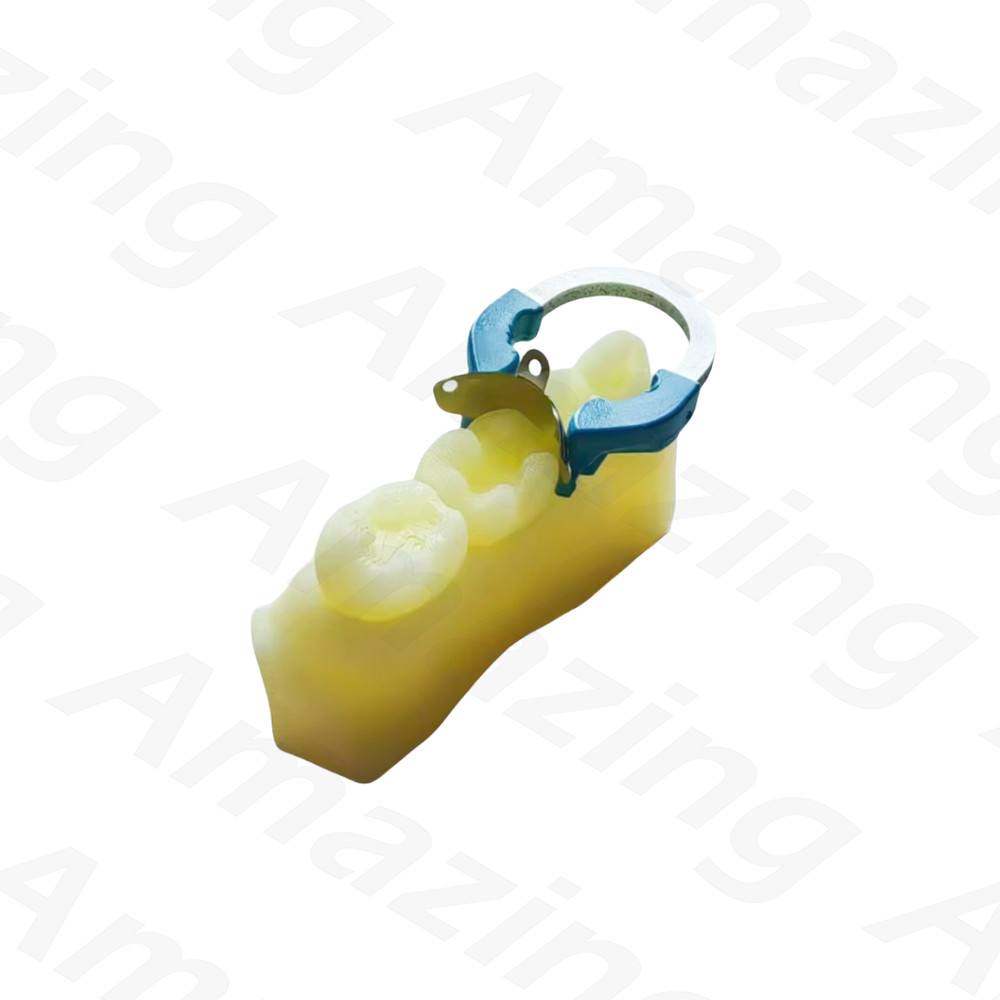Dental Caries Decay Teeth Model Composite Resin Restore Tooth Simulate Class II
