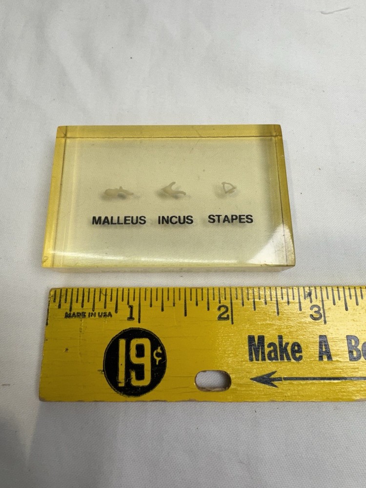 Vintage Embedded Specimen Human Ossicles Ear Bones Osteology
