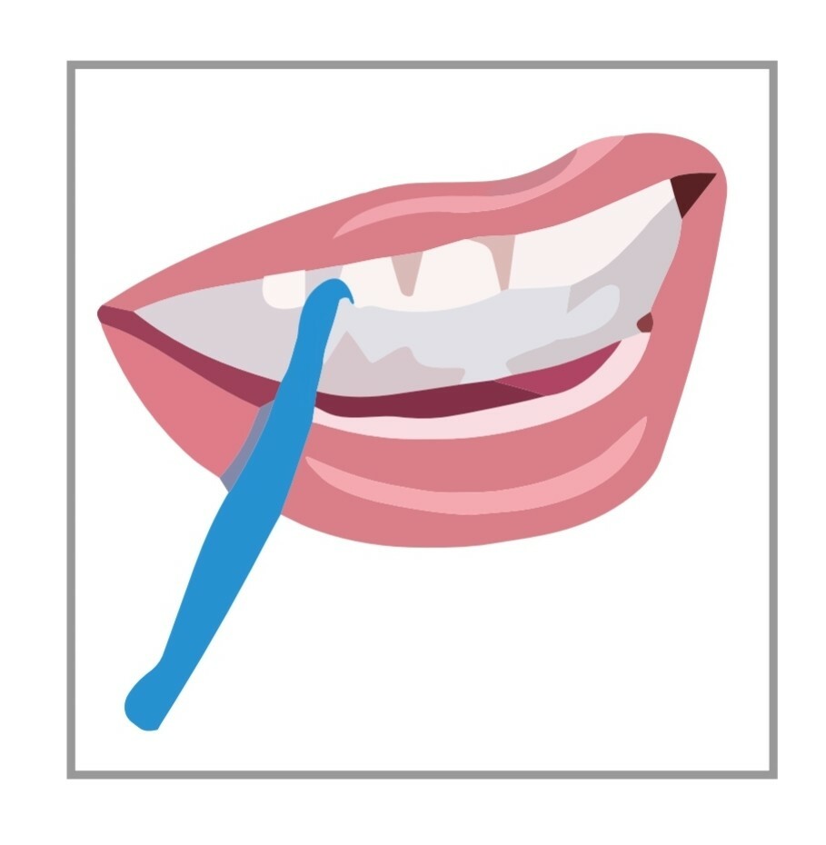 100 Pcs Aligner Retainer Retriever Remover Blue