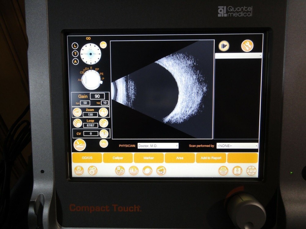 Quantel compact touch 2 touch scan A scan B scan ophthalmic ultrasound