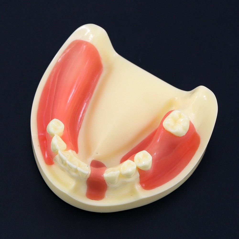Dental Implant Practice Teeth Model Cutting Suturing Typodont M2004