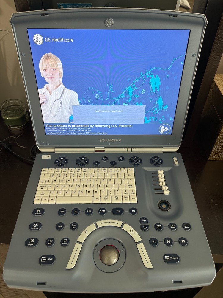 GE VOLUSON E - BT14 OB/GYN ULTRASOUND BOX ONLY