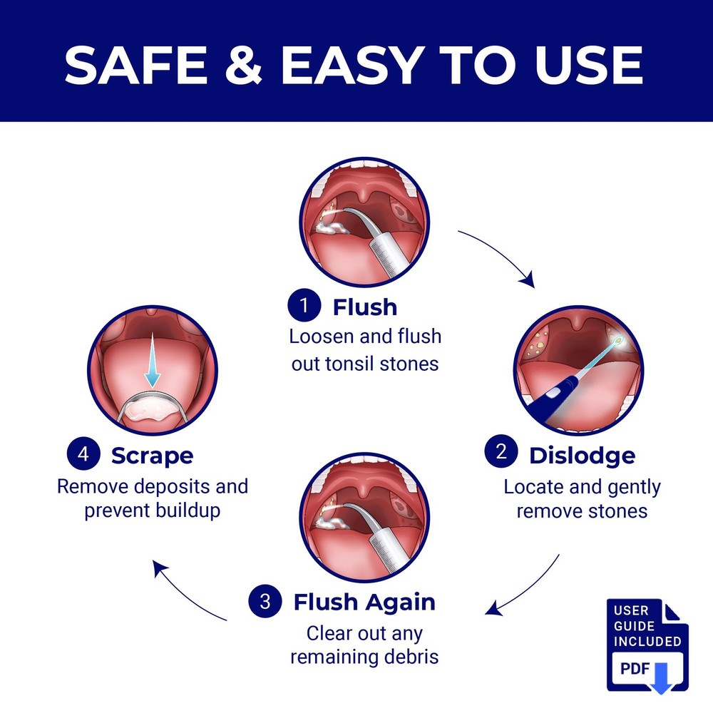 Tonsil Stone Remover - Tonsil Stone Removal Kit - Tonsillolith Remover Tool - To