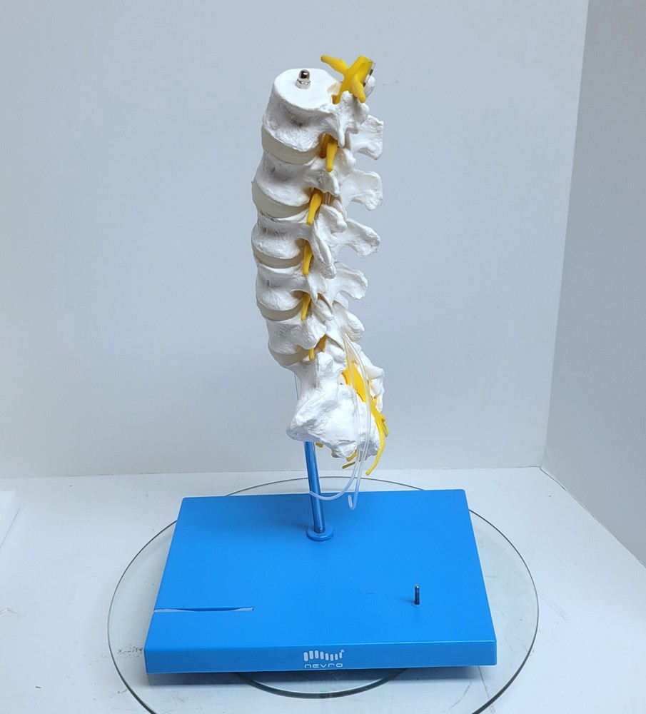 Nevro Medical Spine Model Display