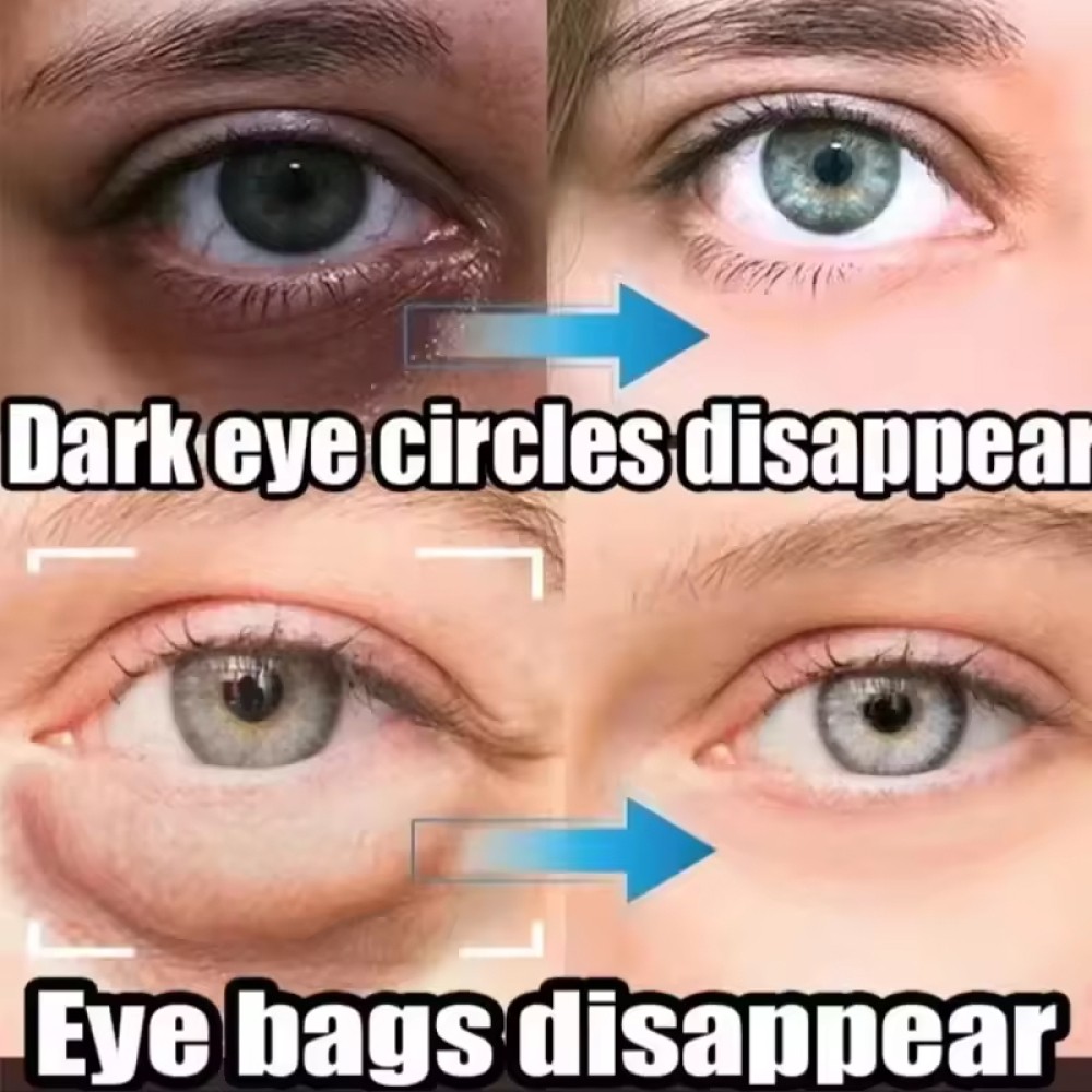 3-Under Eye Cream Remove Dark Circles Bags Face Lines Ageless Wrinkles Puffy Eye