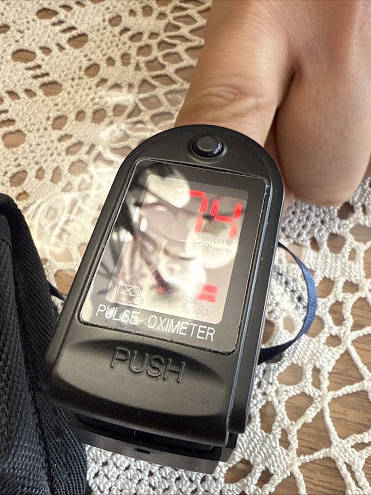 Contec Pulse Oximeter CMS50DL