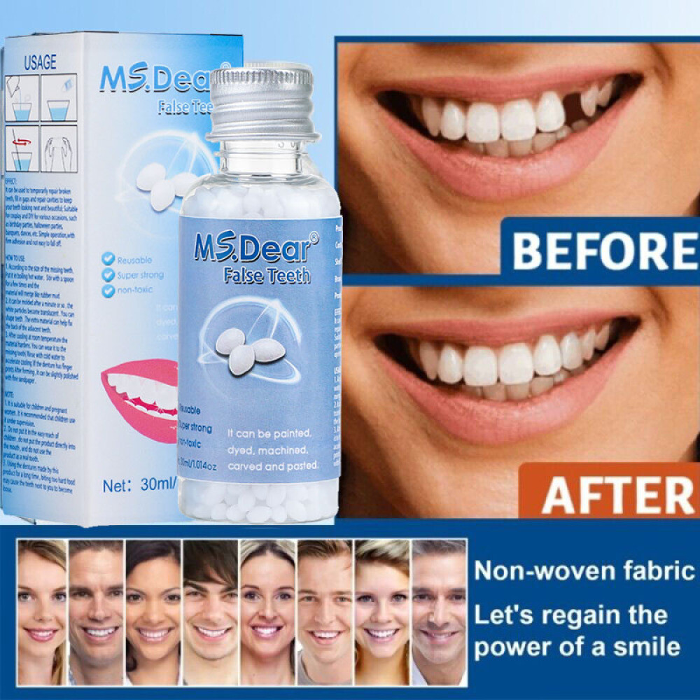 Resin False Teeth Solid Glue Temporary Tooth Repair Set Teeth And Gap Adhesive