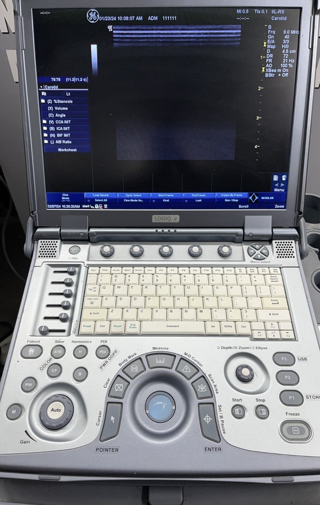 GE Logiq E - Good Working Condition